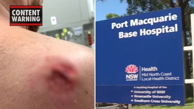 Port Macquarie Base Hospital staff injured in ‘bloody attack’ (9 News)