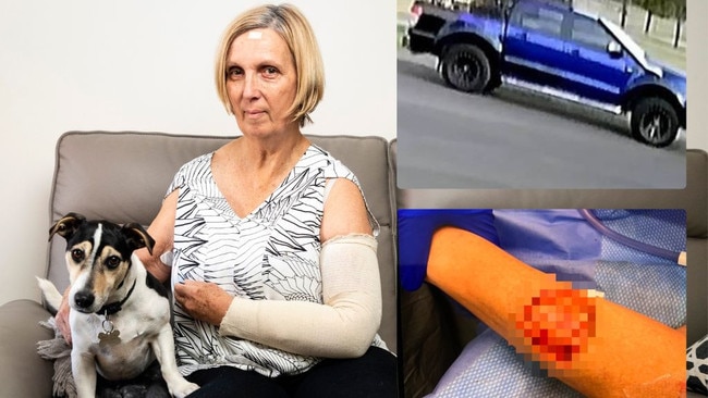 Darling Heights woman Vyvyan Glover with Kemba (left) was the victim of a vicious dog attack, with Toowoomba Regional Council calling for information to identify the owner of a blue ute that was seen leaving the scene of the incident.