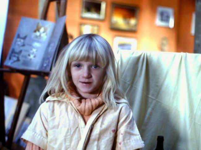 Congenital heart disease survivor Jeanette Manson as a "blue" child with Cyanosis - before age of nine.