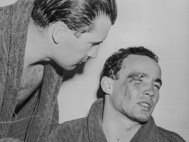 An injured member of Hungarian water polo team after competing against Russia in the 1956 Olympic Games in Melbourne.