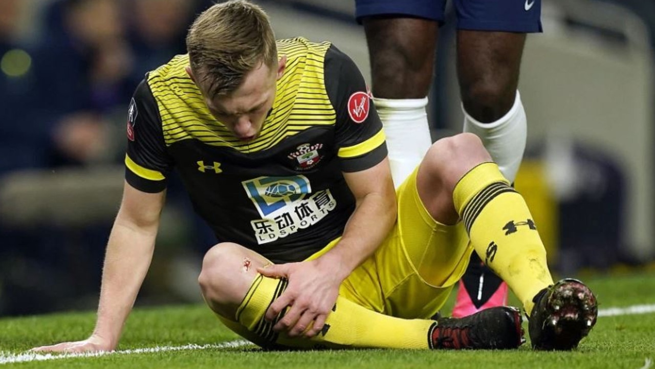 James Ward-Prowse suffered the injury in the defeat to Tottenham.