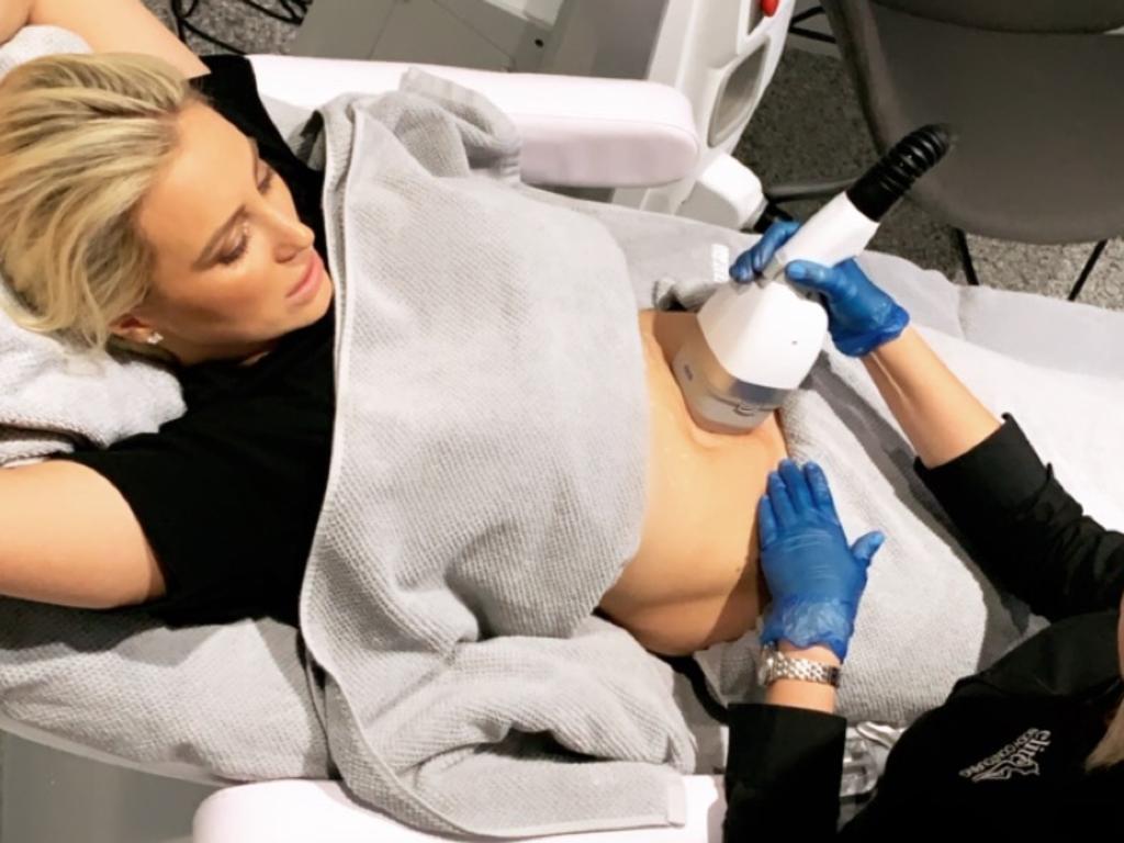 She’s begun having LIPOcel, saying she just doesn’t have the drive to exercise like she used to.