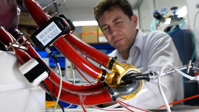 Doctors hope the artificial heart implant may become an alternative for those unable to wait for a donor heart transplant. Picture: Supplied.