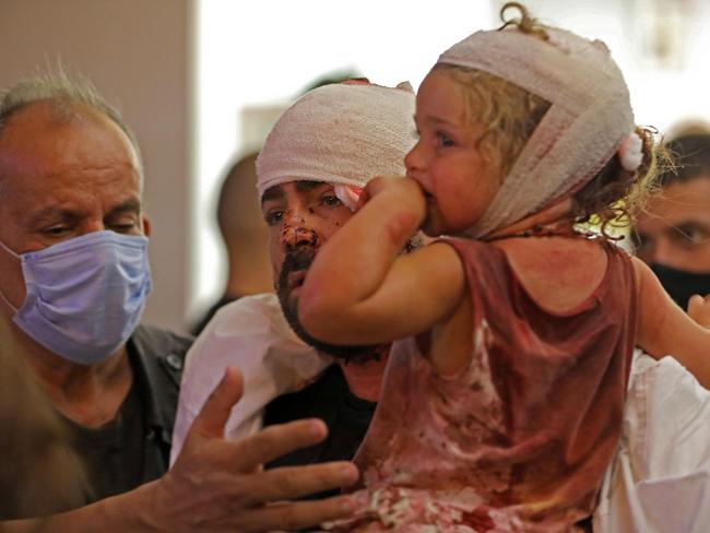 A wounded child is treated shortly after the explosion. Picture: Ibrahim Amro/AFP