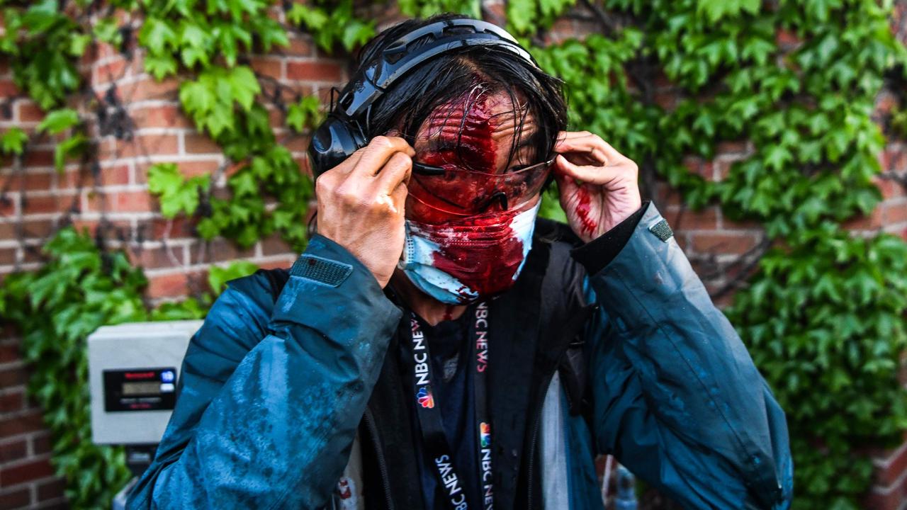 Journalist Ed Ou told The New York Times a projectile fired by the police while he was covering a protest in Minneapolis had wounded his scalp. Picture: Chandan Khanna/AFP