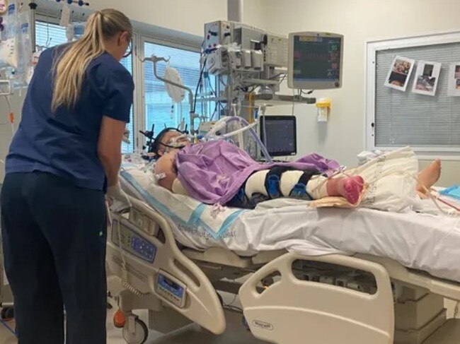 Mackay teen Zoe Hoffman was seriously injured when the bike she was riding and a car collided at Mount Pleasant. Loved ones have started a GoFundMe to help her family during this terrible time as she remains in ICU in Townsville.