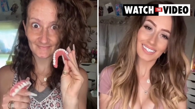 Toothless Mum Shows Off Incredible False Teeth Transformation Photos