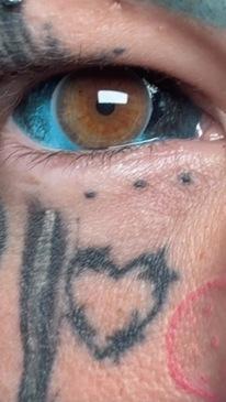 Aussie woman tattoos eyes for a 2nd time after nearly going blind