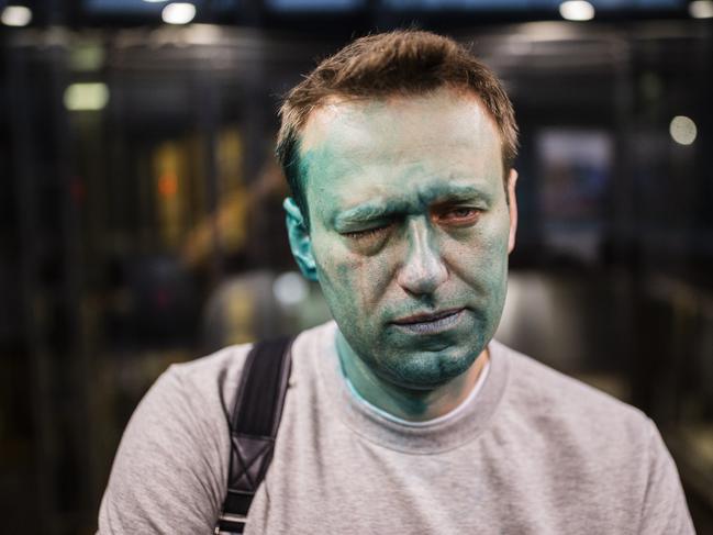 Navalny looks into the camera on the way back to his office from the hospital in Moscow. Picture: Evgeny Feldman