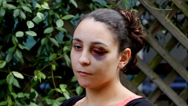 Natalie Hotait was attacked and bashed from behind in Blacktown, she suffered injuries to her eye and ribs.Natalie Hotait