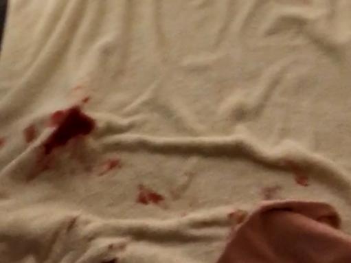 A video taken by the woman who was sexually assaulted by Jarryd Hayne showing blood on her bed. Picture: Supplied via NCA NewsWire