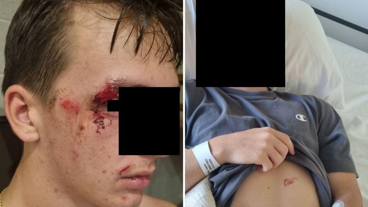 ‘Blood everywhere’: Mum’s fury as teen son cleaned up in alleged hit-run