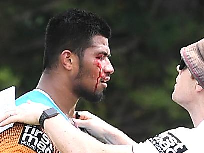 Payne Haas with a cut head at training. Brisbane Broncos training at the Clive Berghofer Centre.Tuesday March 26, 2019. (AAP image, John  Gass)