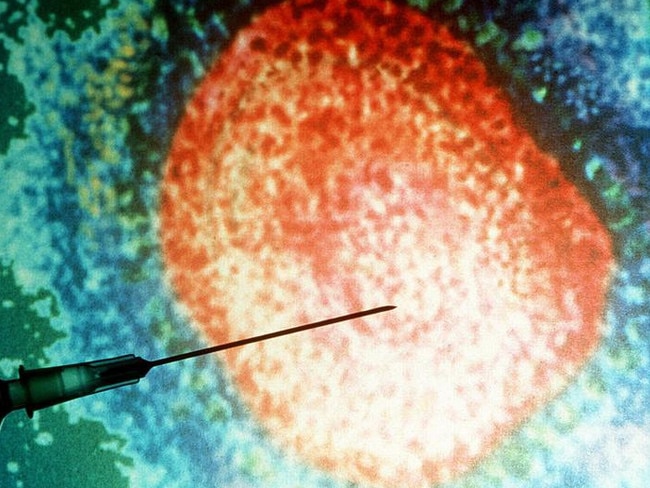 Measles generic.  Picture: Getty