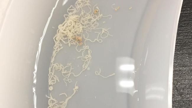 The worms extracted out of an adult green tree snake that was brought in to the Brisbane Bird and Exotics Veterinary Service in Greenslopes recently. Credit: BBEVS