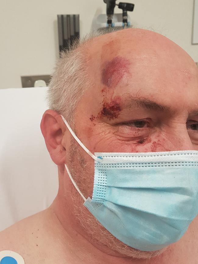 Trevor Dunmall has been left with head and facial injuries after he was attacked by a thug at Cranbourne Park shopping centre.