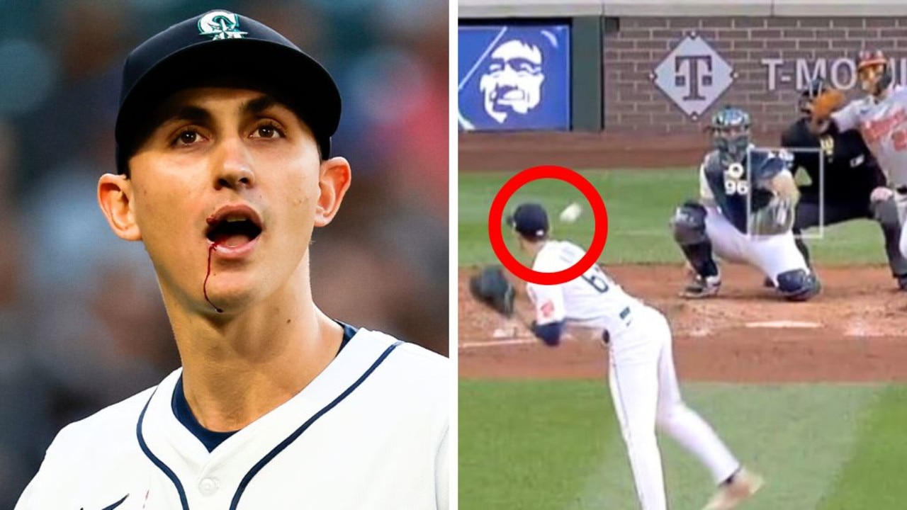 Scary scenes as pitcher hit in face with baseball