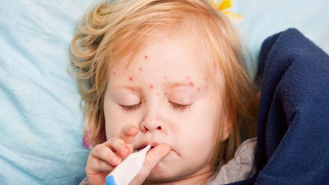 Two new measles cases in SA as health authorities urge people to ensure ...