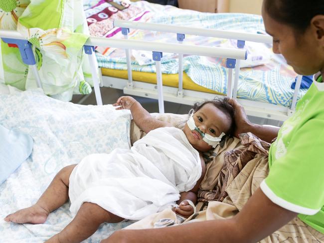 Monalisa Matulino with her seven-month-old Tiresa Muliselu Tupua Tamasese Meaole Hospital. Picture: Infinity Images Fiji.