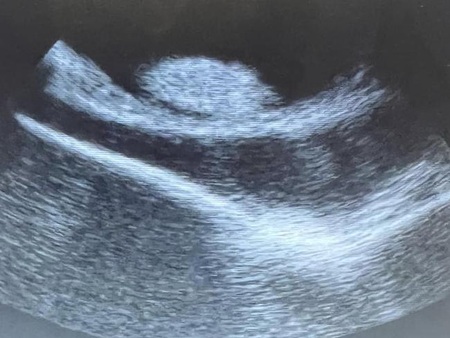 An ultrasound confirmed Charlotte's shock pregnancy. Picture: Acquarium & Shark Lab / Facebook