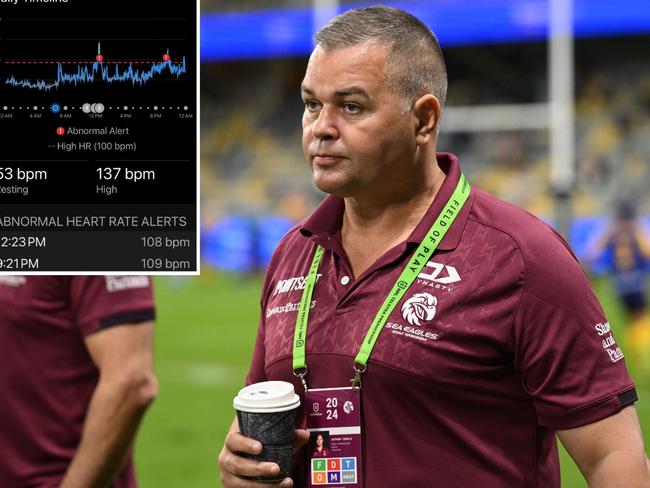 Anthony Seibold's heart rate.