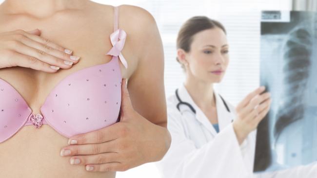 Screening programs for breast cancer are expected to cut cancer death rates. Picture: iStock