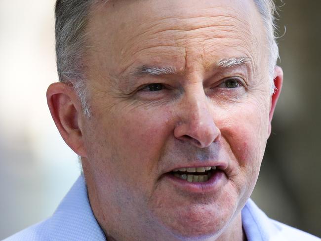 SYDNEY, AUSTRALIA - JANUARY 09, 2021: Anthony Albanese Leader of the Opposition and Leader of the Labor Party is seen leaving the RPA Hospital today after a car accident yesterday in Marrickville in Sydney, Australia. Picture: Newscorp - Sunday Telegraph / Gaye Gerard