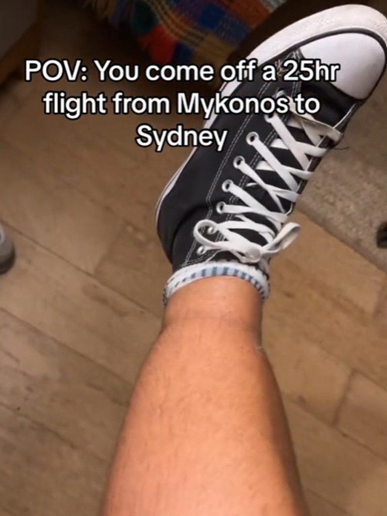His legs had swollen above his socks. Picture: TikTok / @thomassdowling