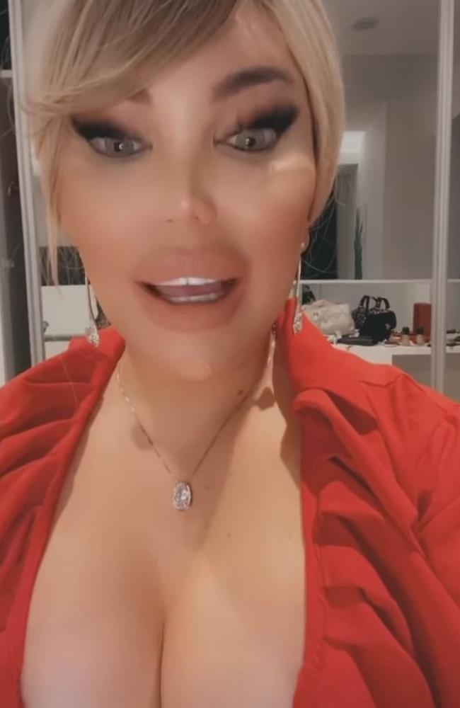 Jessica Alves, also known as the ‘Human Ken Doll’ revealed on Tuesday she was left with hole in her chin following a botched filler job. Picture: Instagram/Jessicaalvesuk