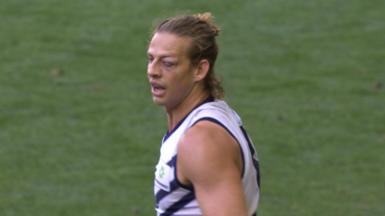 Fremantle skipper Nat Fyfe supporter a decent shiner late in his side's loss against Essendon.