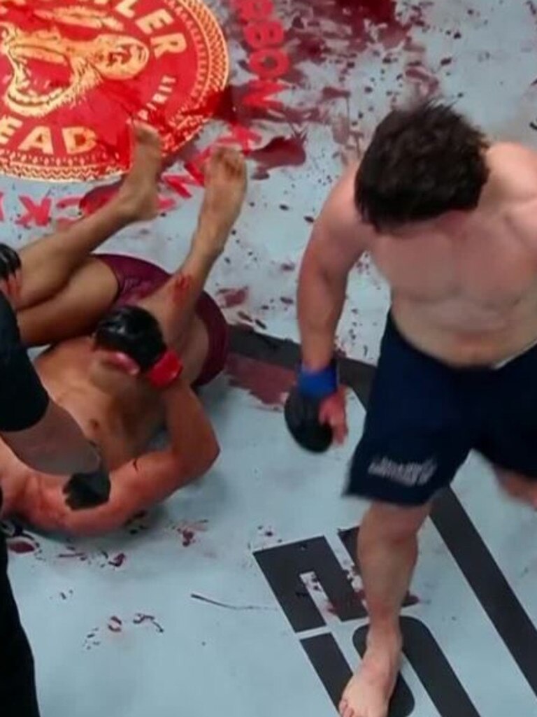 That is a lot of blood on the canvas.