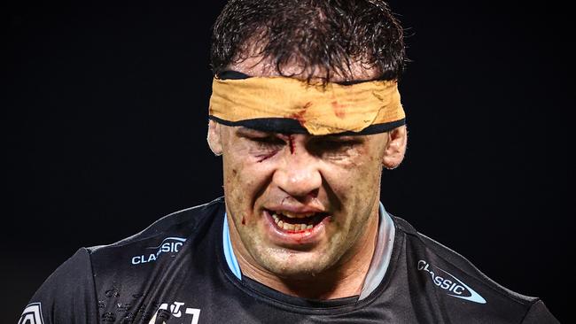 SYDNEY, AUSTRALIA - MARCH 23: 7 Dale Finucane of the Sharks walks off after receiving a cut during the round three NRL match between Wests Tigers and Cronulla Sharks at Leichhardt Oval, on March 23, 2024, in Sydney, Australia. (Photo by Jeremy Ng/Getty Images)