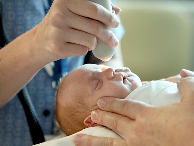 The Retcam is used to test the sight in premature babies. Here, baby Christopher has his eyes tested at the Mater Hospital. 