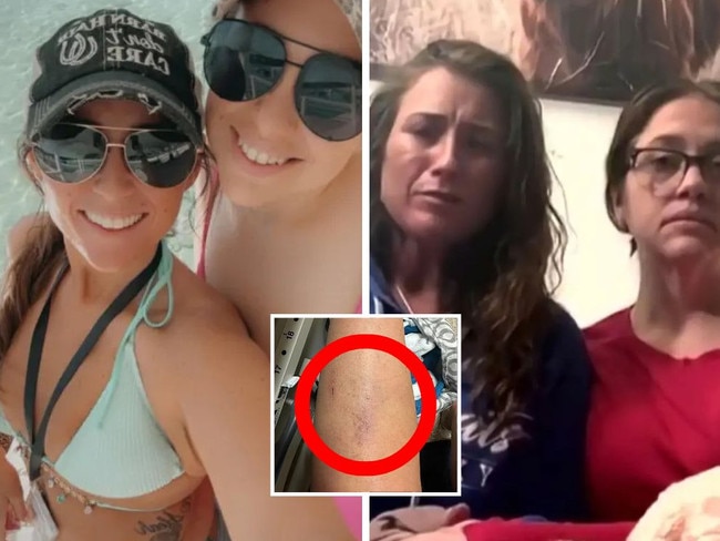 Longtime friends Amber Shearer and Dongayla Dobson said their first kid-free vacation ended with a traumatic, broad-daylight assault. Picture: Supplied