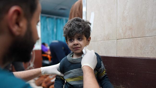 A child receives treatment after an Israeli attack on Nuseirat refugee camp. Picture: AFP