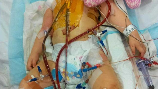 LITTLE FIGHTER: Mother Jodie Winderfich said the confronting photo of Rita fighting for her life was a reminder of how far her daughter had come.