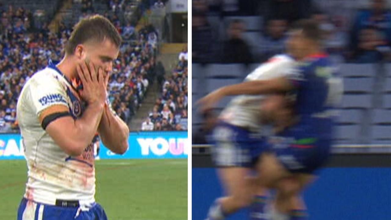 NRL great unleashes after ugly late hit