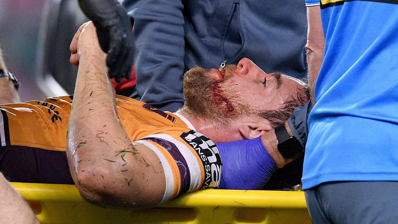 Andrew McCullough of the Broncos is stretchered from the field after a hit from Dylan Napa.