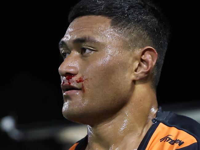 SYDNEY, AUSTRALIA - JULY 06: Stefano Utoikamanu of the Wests Tigers leaves the fiels with a bloody nose and ripped shirt during the round 18 NRL match between Wests Tigers and Melbourne Storm at Leichhardt Oval, on July 06, 2024, in Sydney, Australia. (Photo by Scott Gardiner/Getty Images)