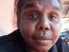 Family seek answers after grandmother’s leg left on highway
