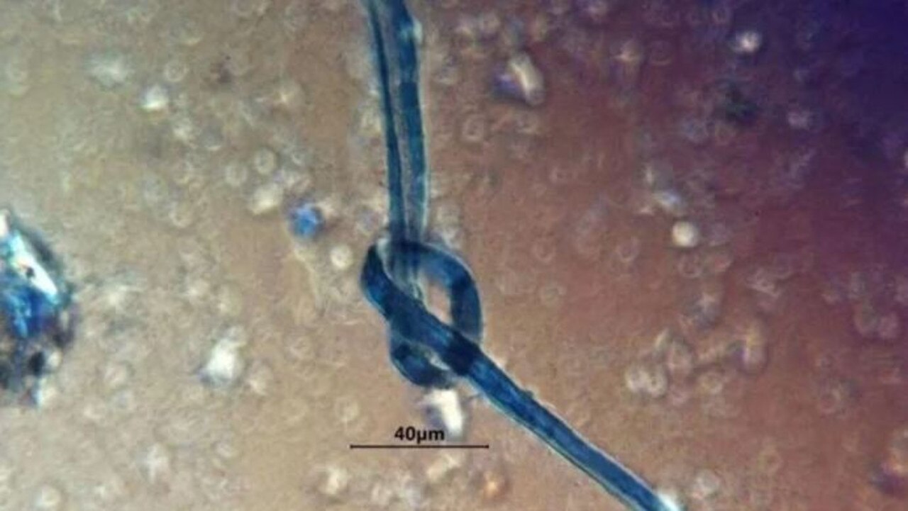 Blue fibres found on the teeth of some victims may suggest many were gagged before they were killed, researchers say.