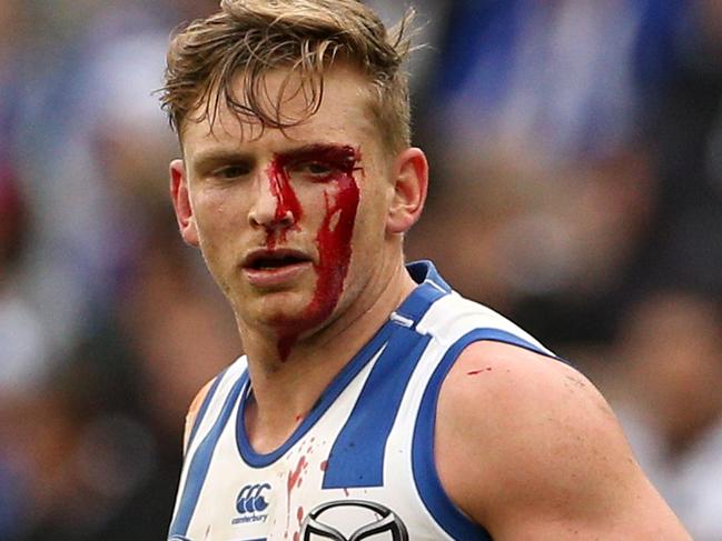 Jack Ziebell of the Kangaroos leaves the field bleeding during the Round 18 AFL match between the Collingwood Magpies and the North Melbourne Kangaroos at the MCG in Melbourne, Saturday, July 21, 2018. (AAP Image/Hamish Blair) NO ARCHIVING, EDITORIAL USE ONLY