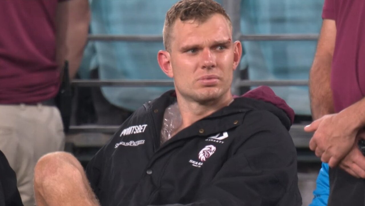 Trbojevic is facing some time on the sidelines. Photo: Fox Sports