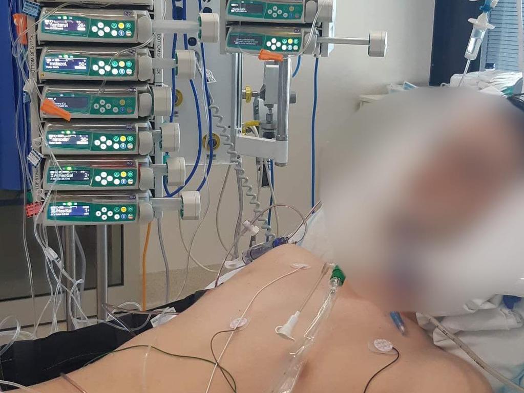 A teenage boy, fighting for life in hospital after an alleged attack at a Maryborough skatepark, was turning his life around after being involved in a vandalism incident.