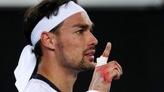 Fabio Fognini's hand after his win over Jordan Thompson. Picture: Mark Stewart