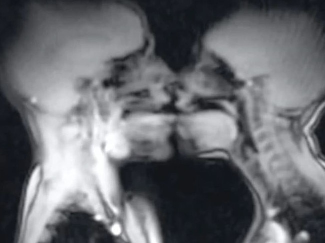 In 1991, a couple had sex in an MRI machine, and the story is going viral on TikTok. Picture: BMJ