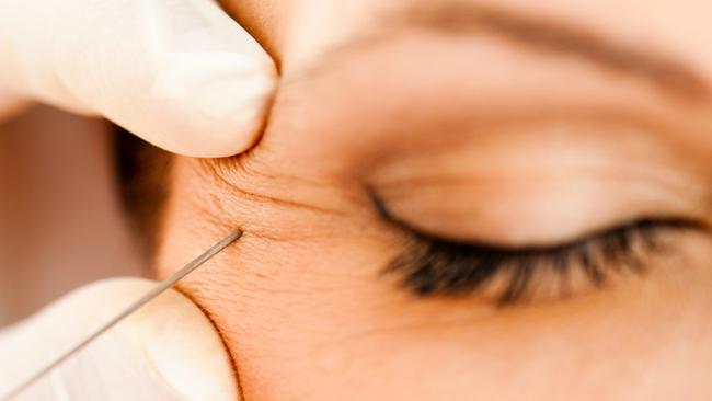 Closeup of botox injection in wrinkle near eye