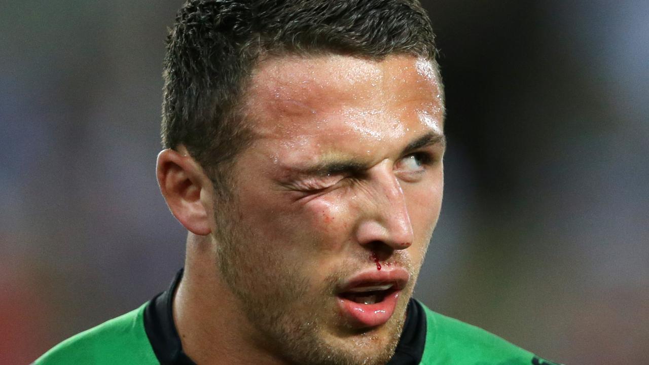 Sam Burgess playing on with a broken cheekbone in the 2014 grand final has gone own in rugby league folklore. Picture Gregg Porteous