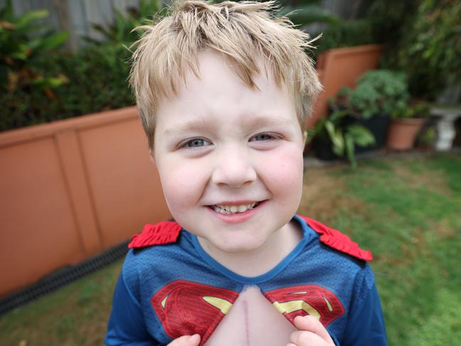 Xavier is on the mend after a successful surgery. Picture: David Caird