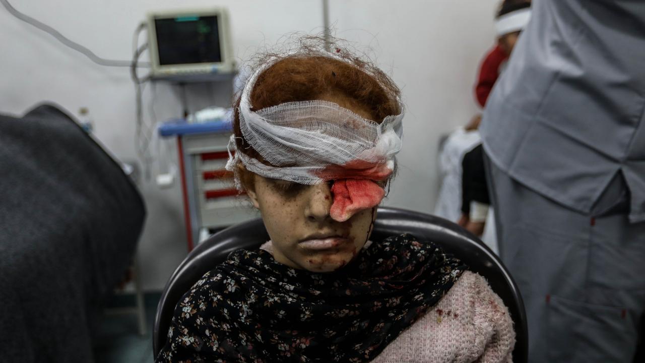 A Palestinian girl is severely injured after Israel targeted Rafah where 1.4m people are sheltering. Picture: Getty Images